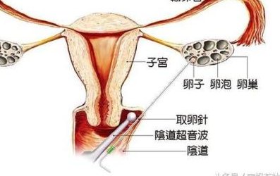 做了结扎手术可以在靖江市试管医院做试管婴儿吗？费用是多少