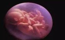 湘潭三代试管婴儿费用组成，附试管注意事项